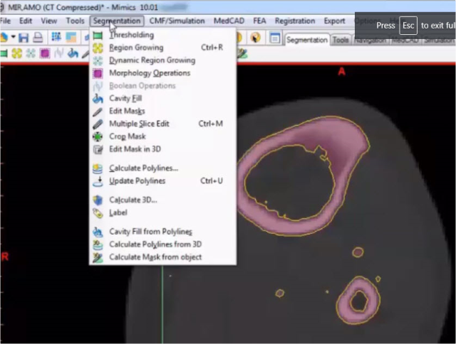 آشنایی با ابزار Morphology Operation در نرم افزار Mimics